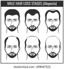 Baldness Type Stock Illustrations Images Vectors Shutterstock