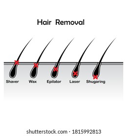 Hair Growth Cycle Skin Isolated On Stock Vector (Royalty Free ...