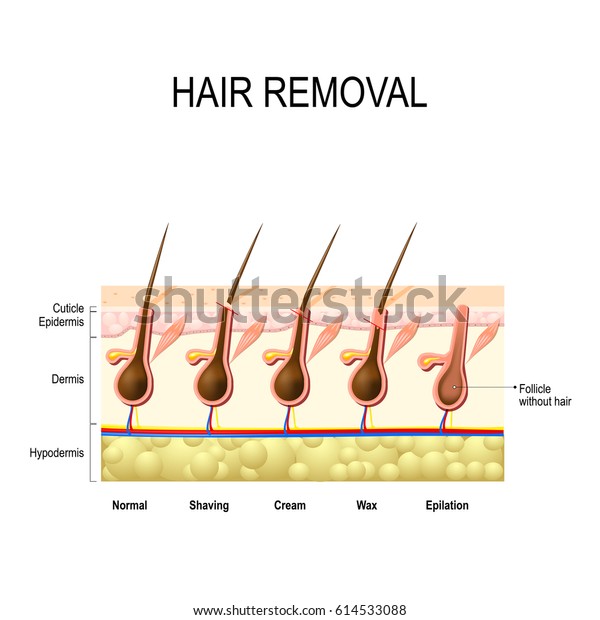 Hair Removal Wax Cream Epilation Shaving Stock Illustration 614533088