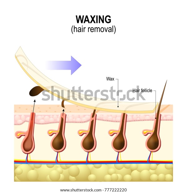 Hair Removal Waxing Form Semipermanent Hair Stock Illustration