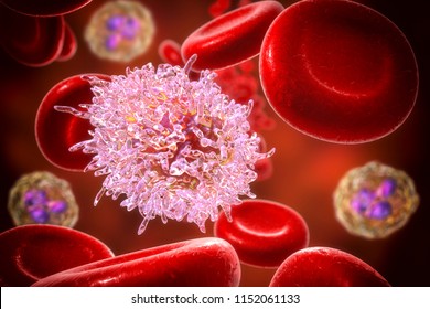 Hairy Cell Leukemia, 3D Illustration. It Is A Hematological Malignancy, Chronic Lymphocytic Leukemia, With Accumulation Of Abnormal B Lymphocytes