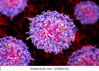 Hairy Cell Leukemia, 3D Illustration. It Is A Hematological Malignancy, Chronic Lymphocytic Leukemia, With Accumulation Of Abnormal B Lymphocytes