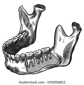 Hand Drawing, Line Art, Engraving, Ink Dental Illustration. Vintage Tooth And Jaws. Isolated In White Background. For Medical Poster And Brochure.