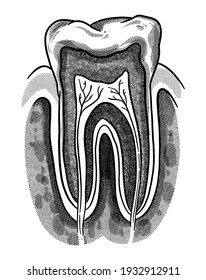 Hand Drawing, Line Art, Engraving, Ink Dental Illustration. Vintage Tooth Structure. Dental Nerves. Isolated In White Background. For Medical Poster And Brochure.