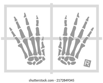 Hands x  ray illustration and sight