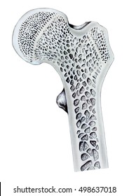 The Head Of A Human Femur Bone, Cutaway Cross Section.
