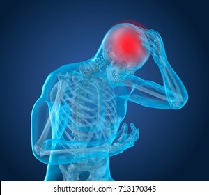 Head pain Attack, man suffering from brain pain. 3D illustration - Powered by Shutterstock