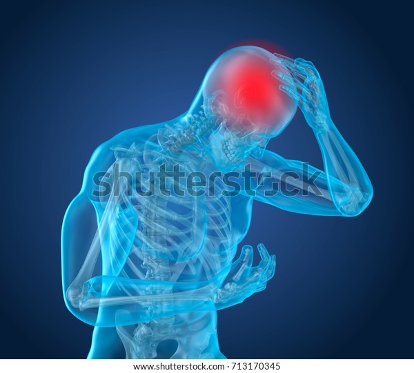 Head pain Attack, man suffering from brain\
pain. 3D\
illustration
