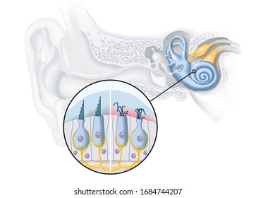 Healthy And Damaged Hair Cells Inside Cochlea