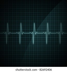 Healthy Heart Beat On Monitor Screen. Medical Illustration.
