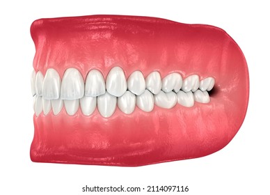 Healthy Human Teeth Normal Occlusion Medically Stock Illustration 