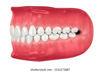 Healthy Human Teeth Normal Occlusion Dental Stock Illustration ...