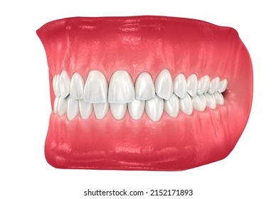 448 Normal bite Images, Stock Photos & Vectors | Shutterstock