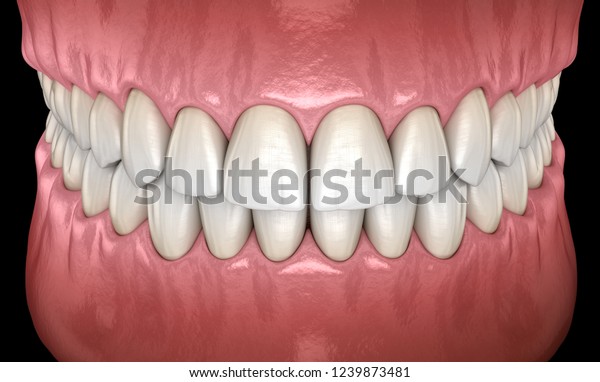 Healthy human teeth with normal\
occlusion frontal view. Medically accurate tooth 3D\
illustration