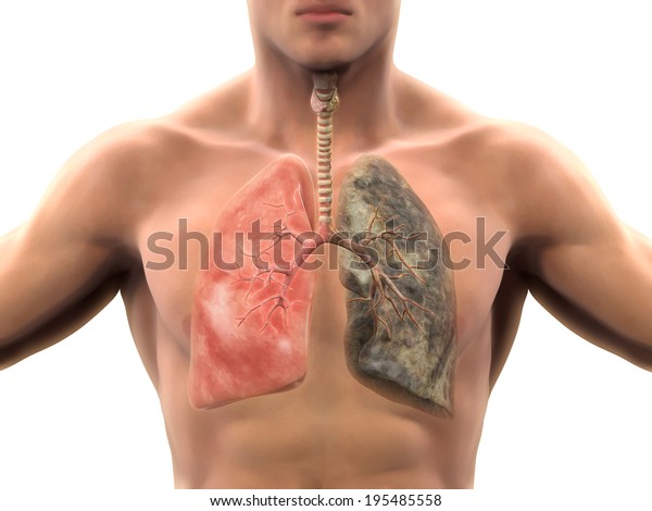 Poumon Et Fumeur Sains Poumon Illustration De Stock