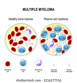 Myeloma Cells Images Stock Photos Vectors Shutterstock