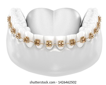 Healthy Teeth With Gold Braces, White Teeth Concept, Dental 3D Illustration