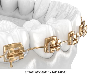 Healthy Teeth With Gold Braces, White Teeth Concept, Dental 3D Illustration