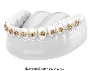 Healthy Teeth With Gold Braces, White Teeth Concept, Dental 3D Illustration