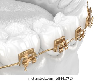 Healthy Teeth With Gold Braces, White Teeth Concept, Dental 3D Illustration