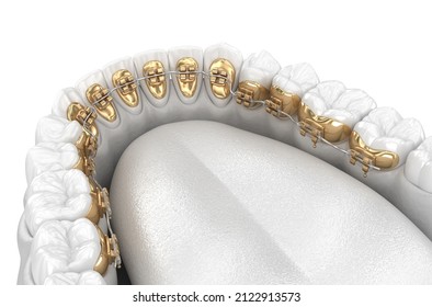 Healthy Teeth With Gold Braces, White Style Concept, Dental 3D Illustration