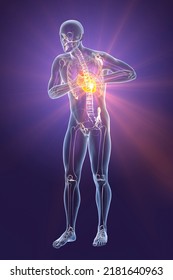 Heart Attack, Conceptual Image For Heart Diseases. 3D Illustration. Heart Pain, Myocardial Infarction, A Man With Chest Pain