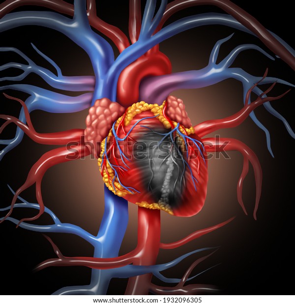 Heart Disease Anatomy Concept Cardiovascular Illness Stock Illustration ...