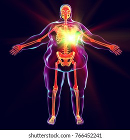 Heart disease in obesity, conceptual image, 3D illustration