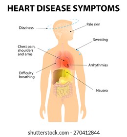 Heart Disease. Signs And Symptoms. Coronary Artery Disease Or Ischemic Heart Disease. Also Known As Atherosclerotic Heart Disease Or Atherosclerotic Cardiovascular Disease And Coronary Heart Disease