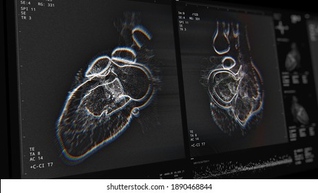 Heart scan screen. Device scans, displays vital signs. Cardiology data. Diagnosis of diseases. Futuristic MRI conept. 3D Render Illustration, glitch and noise effect, color aberrations, Depth of Field
