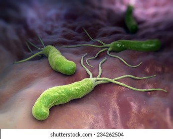 Helicobacter Pylori