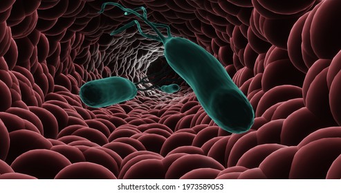 Helicobacter Pylori Infection In 3d Illustration