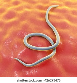 pinworms pinworm fertőzés útvonalai)