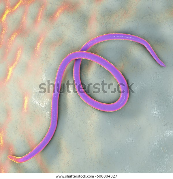 Helminths Nematodes Enterobius Threadworm Which Cause Stock ...
