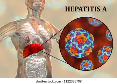 Liver Hepatitis B Infection Highlighted Inside Stock Illustration 1103225852