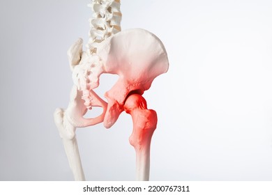 Hip Bone Pain, Human Skeleton Hip Arthritis, 3d Illustration	