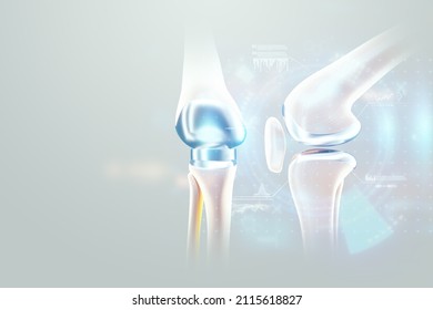 hip implant Medical poster, image of the bones of the knee, artificial joint in the knee. Arthritis, inflammation, fracture, cartilage,. Copy space, 3D illustration, 3D render
