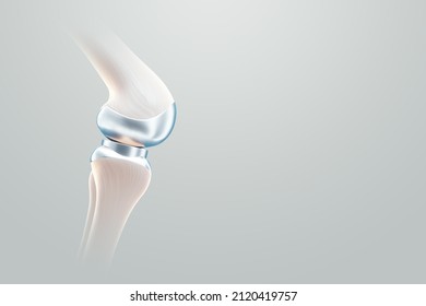 Hip Implant Medical Poster, Image Of The Bones Of The Knee, Artificial Joint In The Knee. Arthritis, Inflammation, Fracture, Cartilage,. Copy Space, 3D Illustration, 3D Render