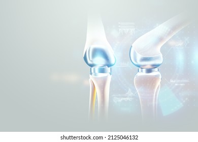 Hip Implant Medical Poster, Image Of The Bones Of The Knee, Artificial Joint In The Knee. Arthritis, Inflammation, Fracture, Cartilage,. Copy Space, 3D Illustration, 3D Render