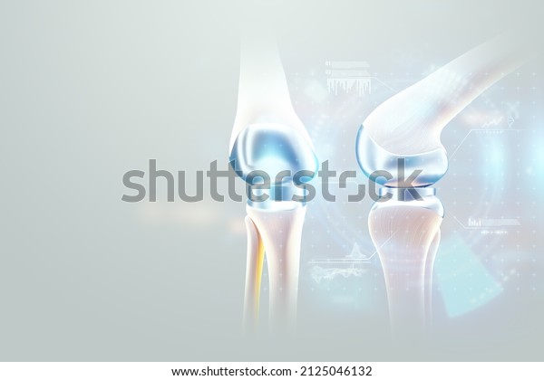 hip implant\
Medical poster, image of the bones of the knee, artificial joint in\
the knee. Arthritis, inflammation, fracture, cartilage,. Copy\
space, 3D illustration, 3D\
render