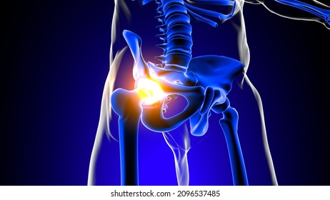 Hip Joint Pain Anatomy For Medical Concept 3D Illustration