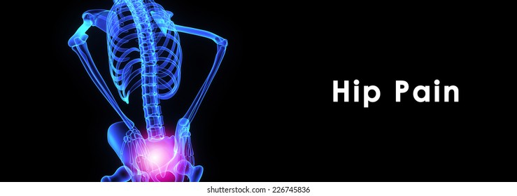 Hip Pain Stock Illustration 226745836 | Shutterstock