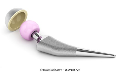 Hip Replacement Implant (3D Rendering)