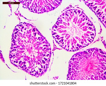 seminiferous tubule histology