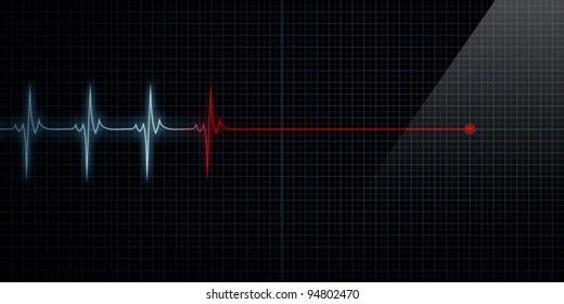 Horizontal Pulse Trace Heart Monitor At Death