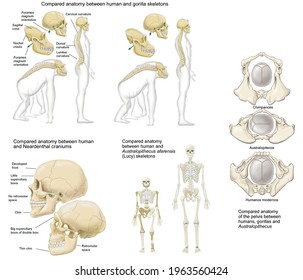 Human Anatomy. The Bones. Elements Of Anatomy Compared Between The Bones And The Skull Of Different Current Primates And Fossils. Humans, Gorillas, Austrolopithecines And Neardentals. 