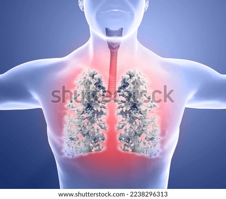 Human anatomy, problems with the respiratory system, severely damaged lungs. Bilateral pneumonia. Covid-19, coronavirus. Patient and smoke. Smoker. 3d rendering