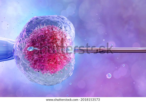 Human artificial insemination, in vitro\
fertilization, reproduction. Female egg cell, needle puncture the\
cell membrane, cell injection, sperm, ovum, zygote. IVF fertility\
treatment medicine, 3D\
image
