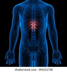 Painful Joints Xray Human Stock Illustration 73006891