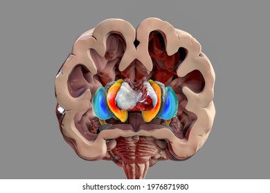 Human Brain Anatomy, Basal Ganglia. 3D Illustration Showing Caudate Nucleus (orange), Putamen (blue), And Lateral Ventricles (gray)